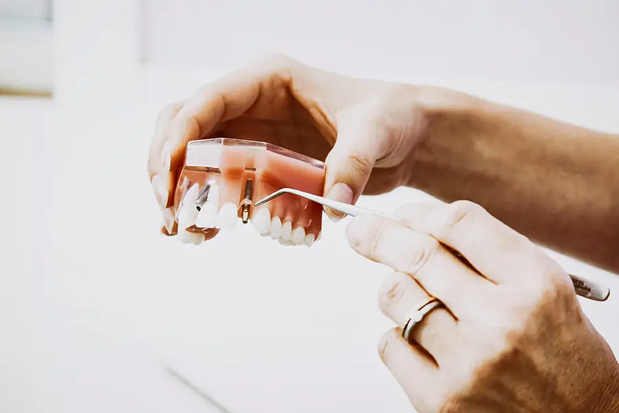 dental-implants